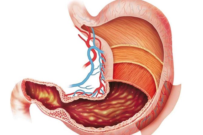 Stomach-1.jpg